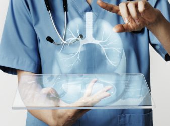 Lung cancer diagnosis using AI