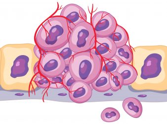 Pan-Cancer T Cell Atlas