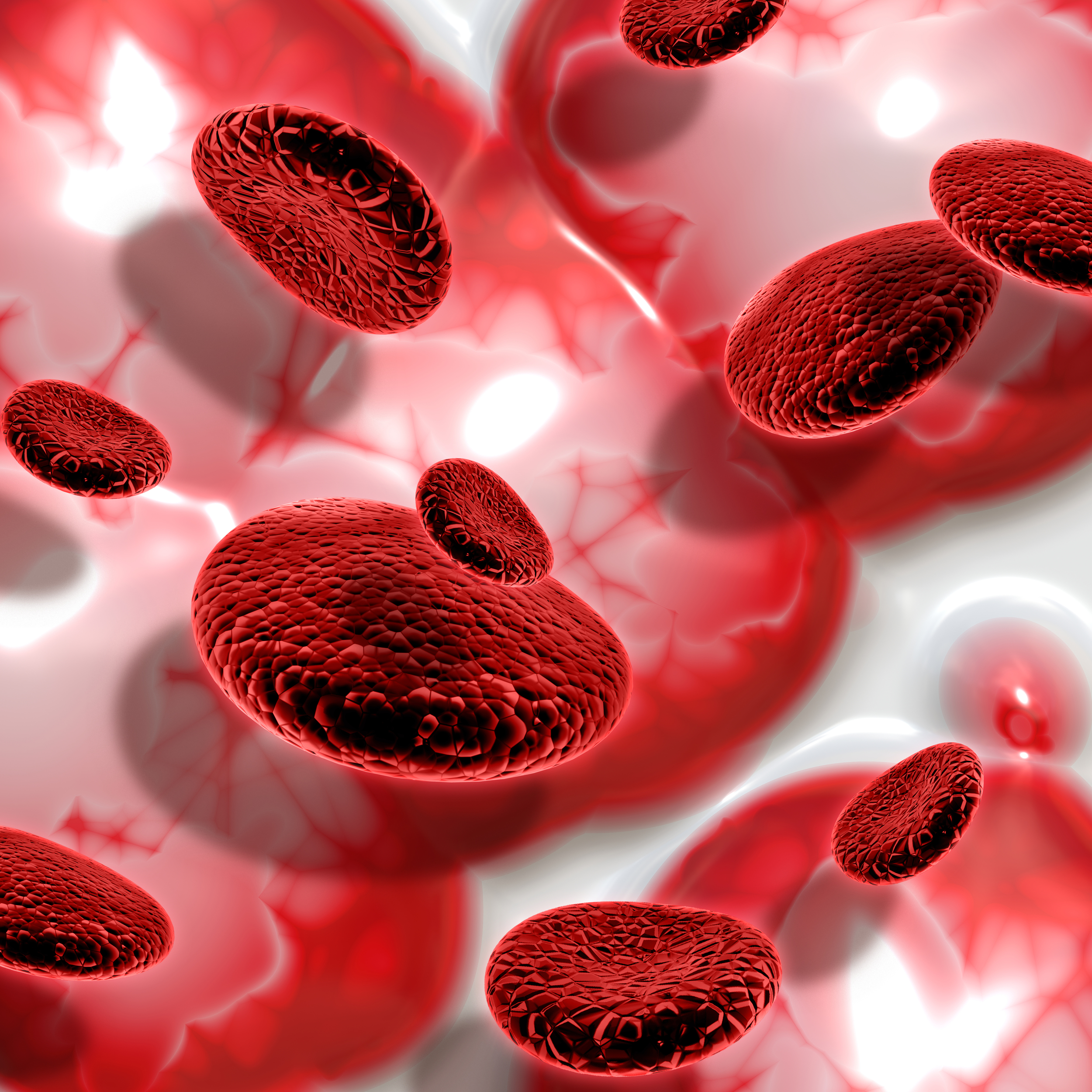 Sickle Cell Disease 11 Times More Deadly than Thought