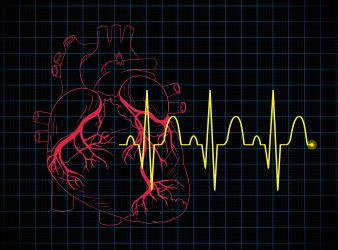 Better Heart Attack Detection With the New AI Tool