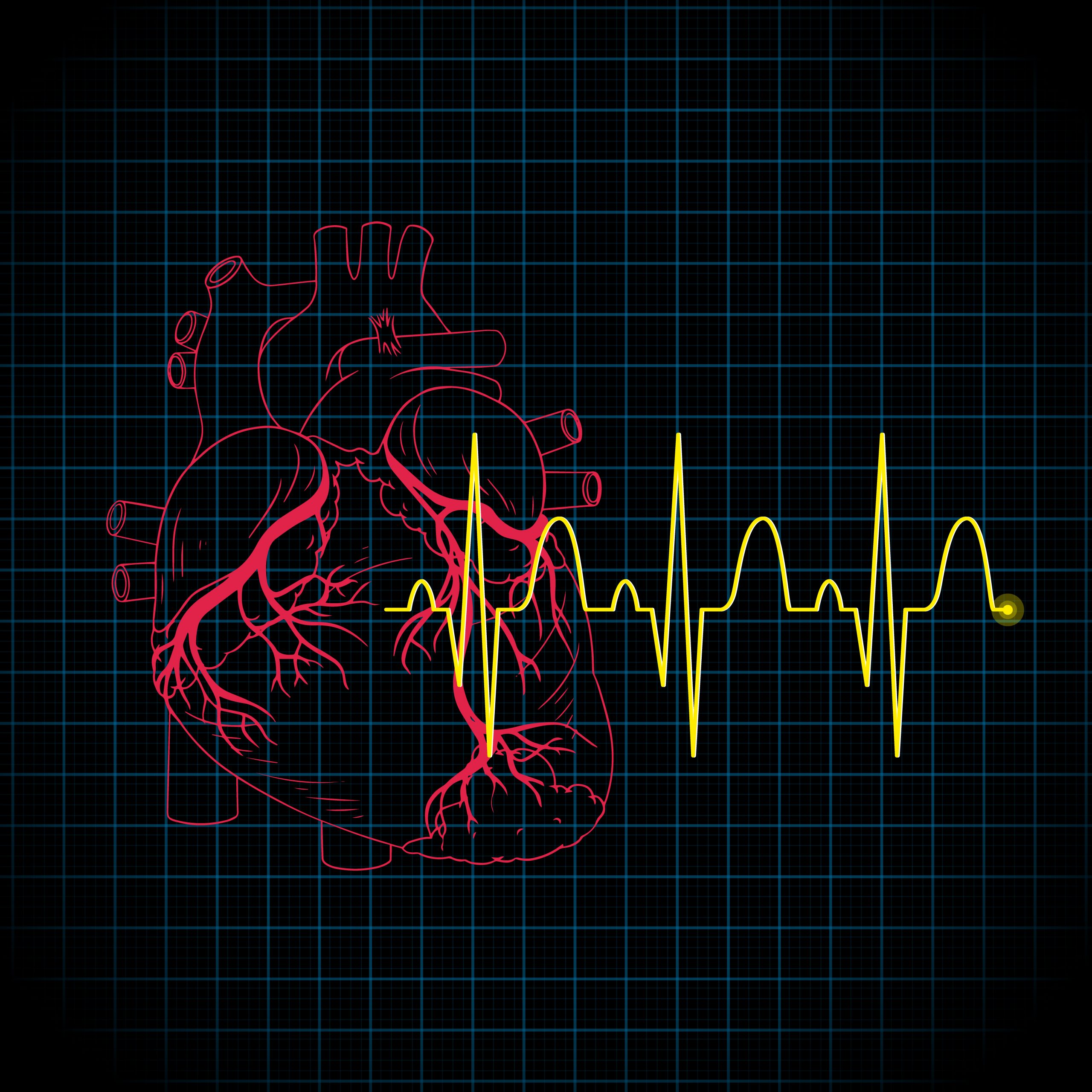 Better Heart Attack Detection With the New AI Tool