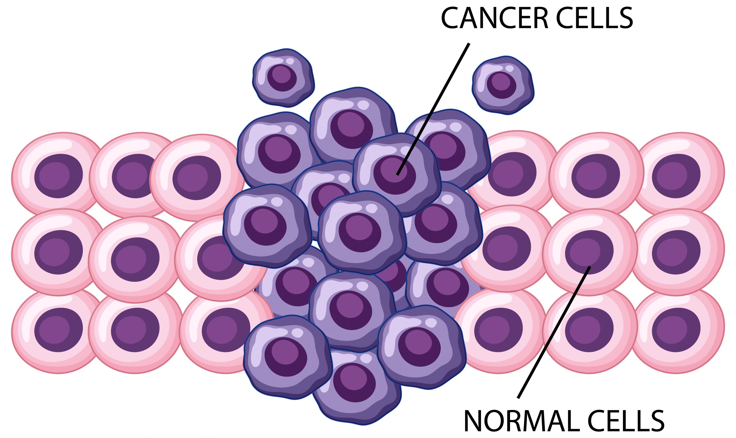 Rare Leukemia in the Skin