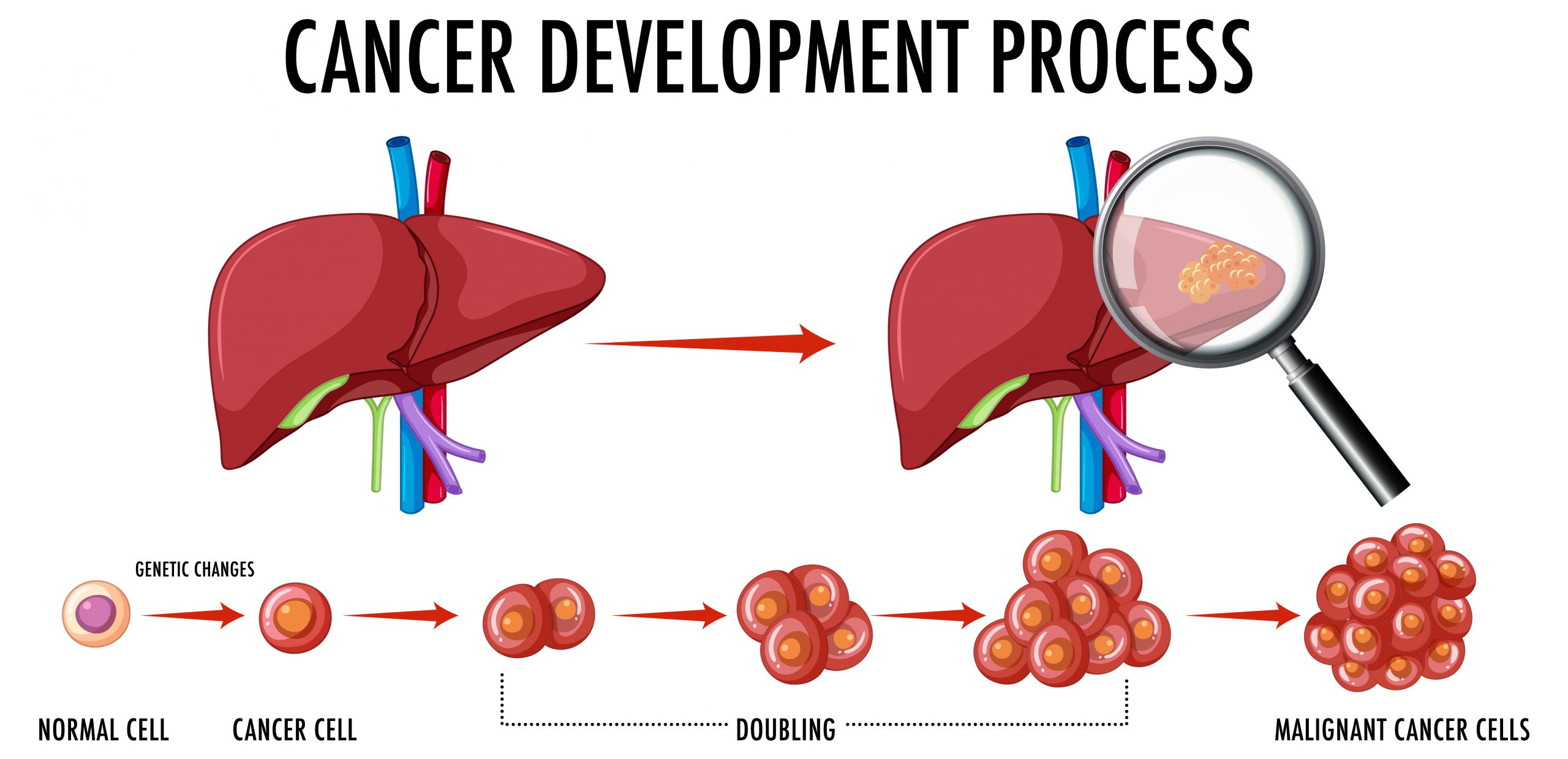 Rare Liver Cancer Proteome Illuminates Basic Biology