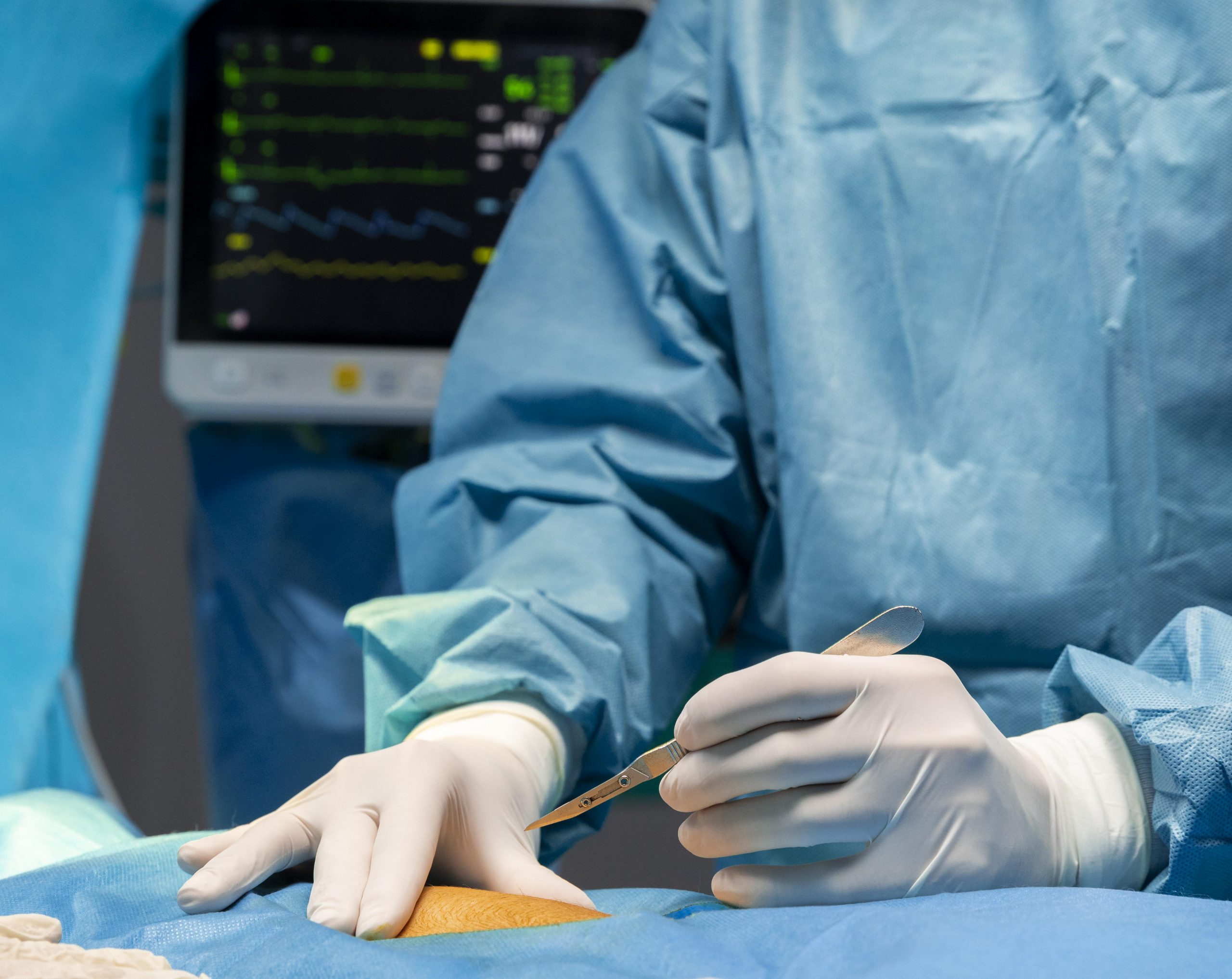 Opioid Use During Surgery Linked with Postoperative Pain