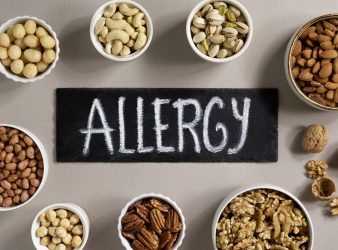 Food Allergy is High in Hispanic, Black, and Asian People