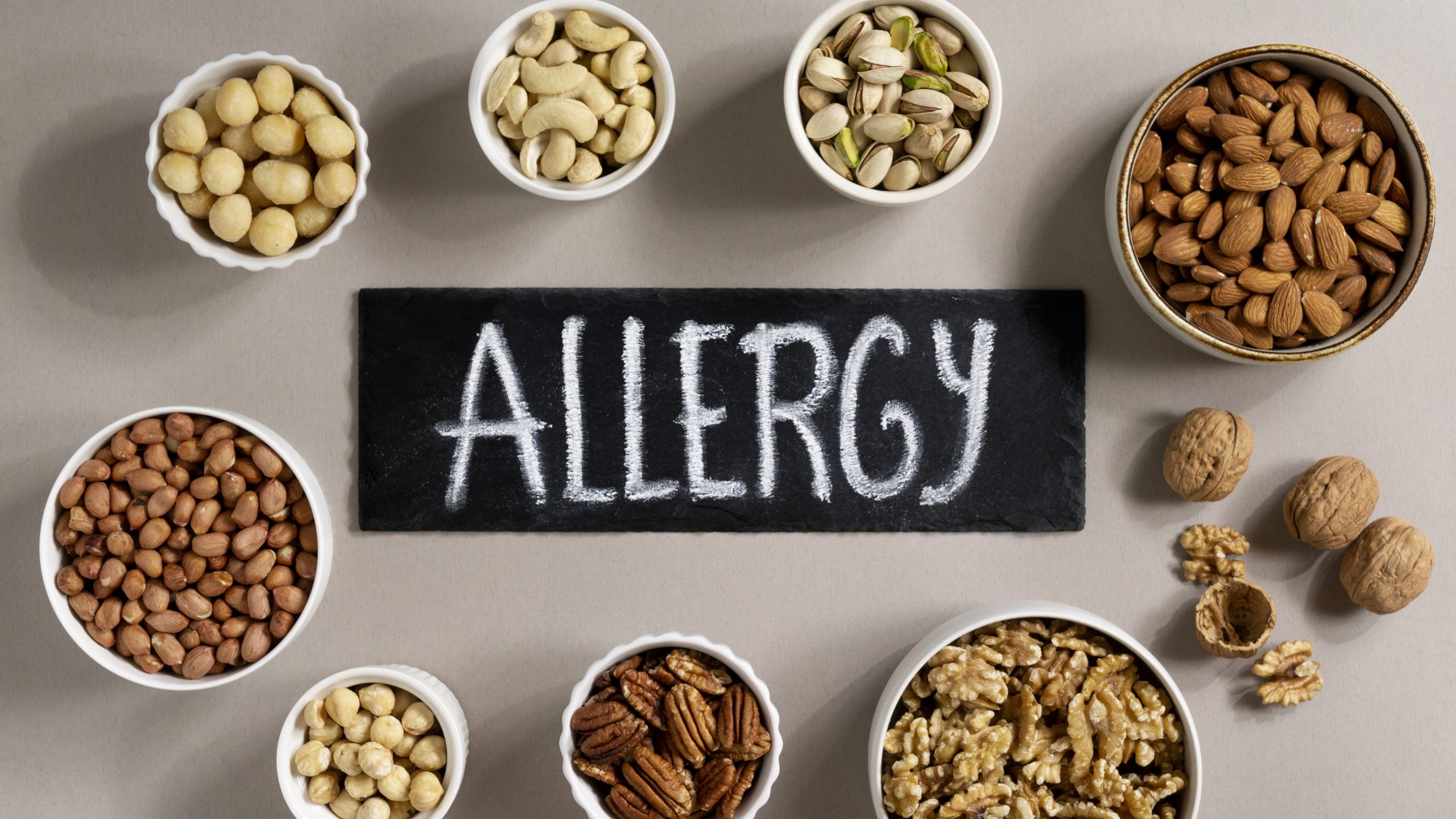 Food Allergy is High in Hispanic, Black, and Asian People