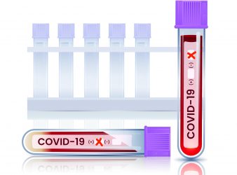 Plasma Lipid Profile and COVID-19 are Interlinked