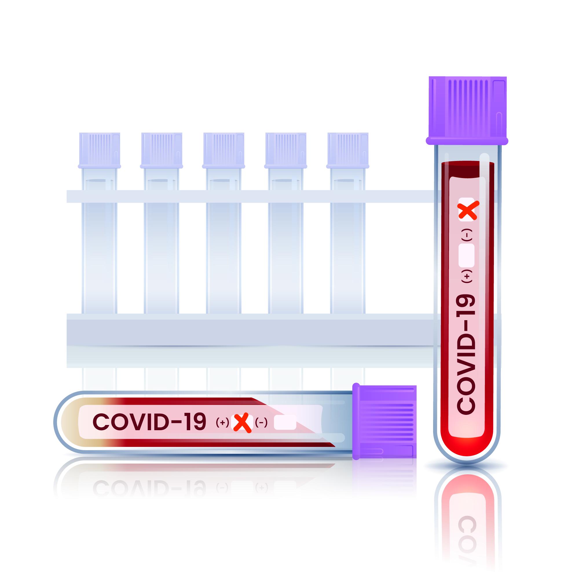 Plasma Lipid Profile and COVID-19 are Interlinked