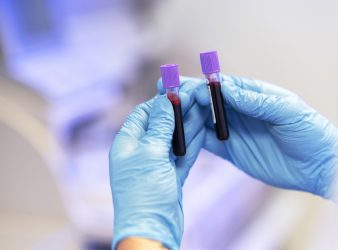 Liquid Biopsy Improved with the Latest Tool