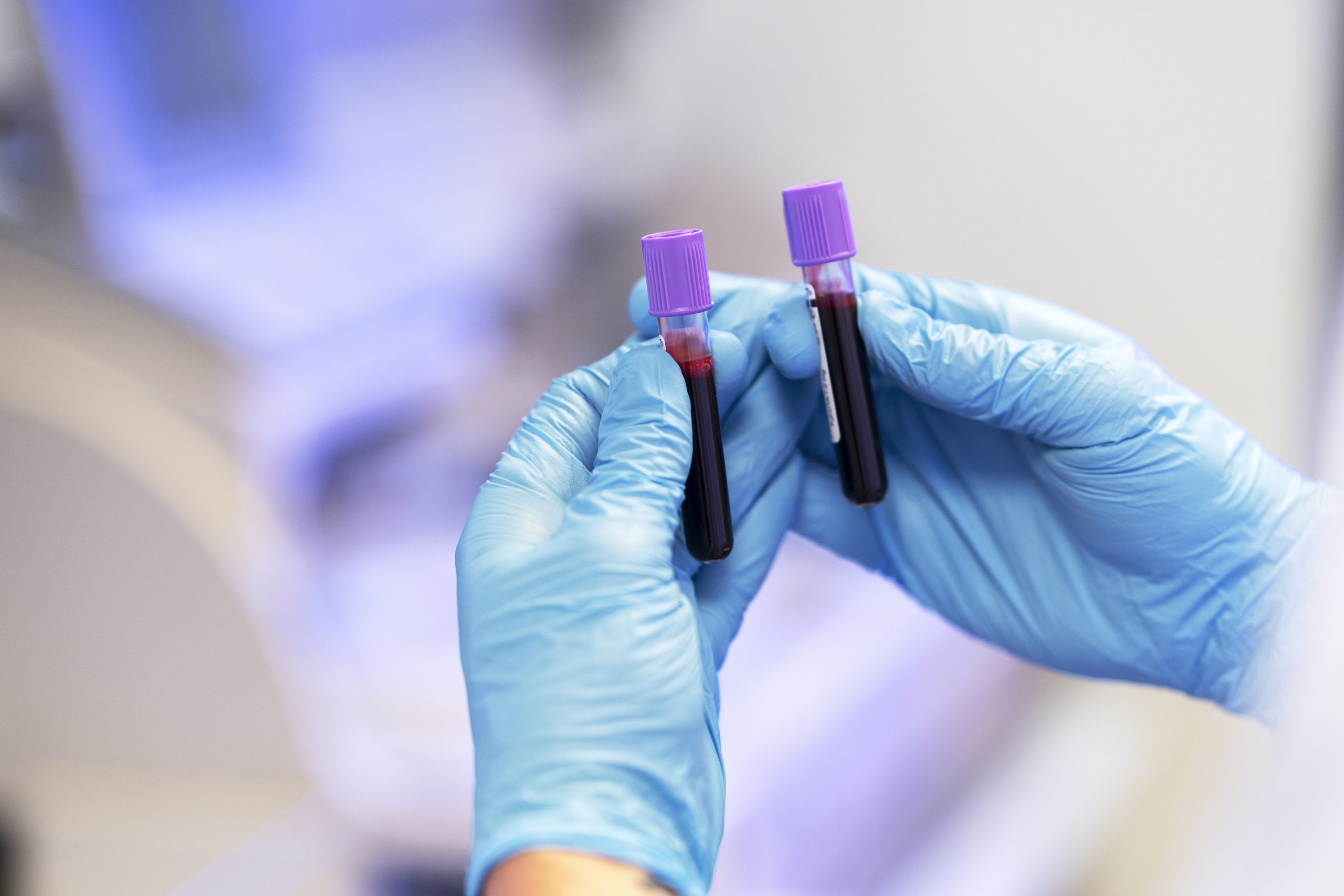 Liquid Biopsy Improved with the Latest Tool