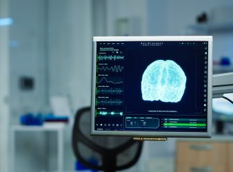 Routine Brain Scan Improves Psychosis Clinical Care