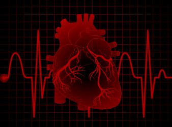 Bone Density Test Predicts Heart Attack Risk