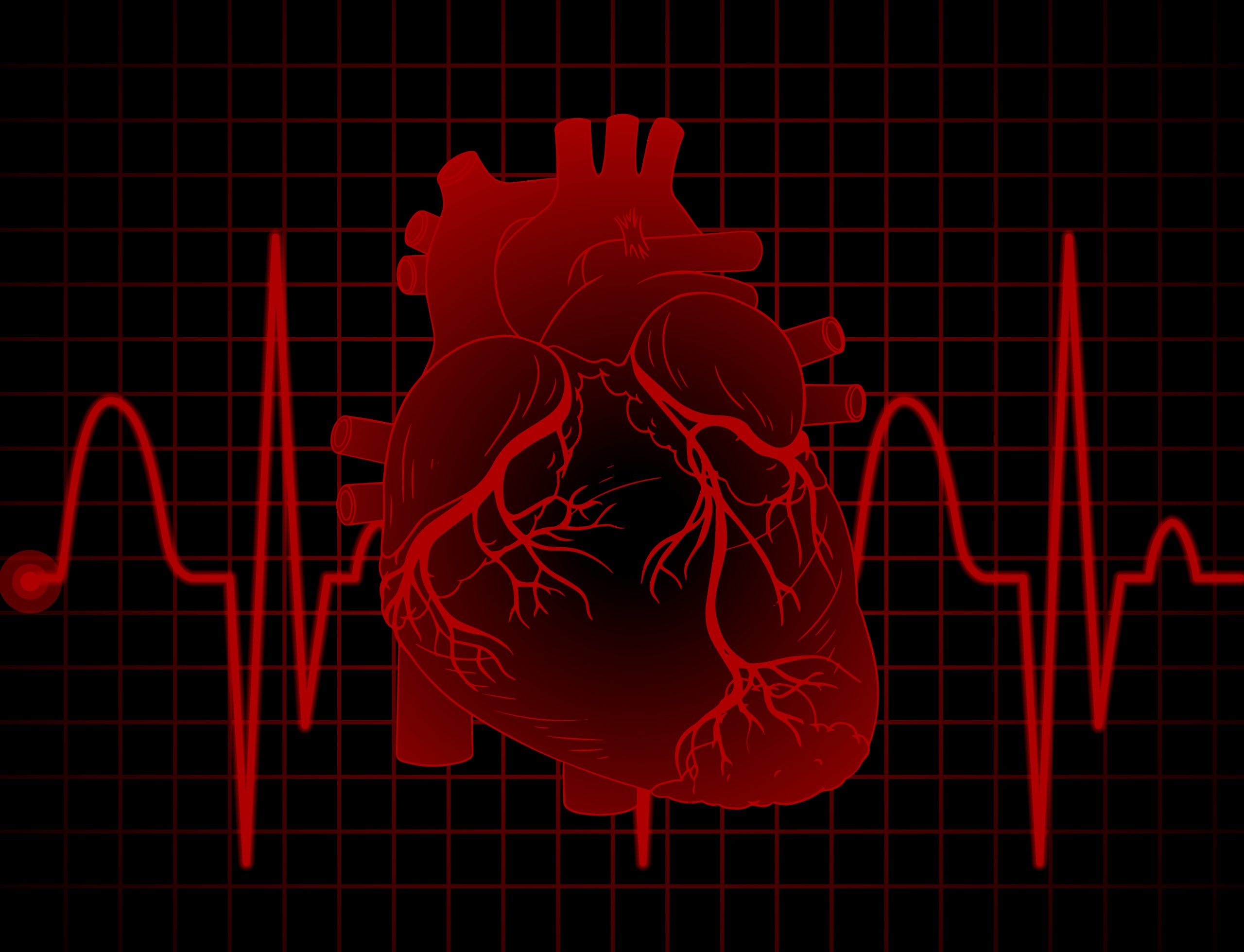 Bone Density Test Predicts Heart Attack Risk