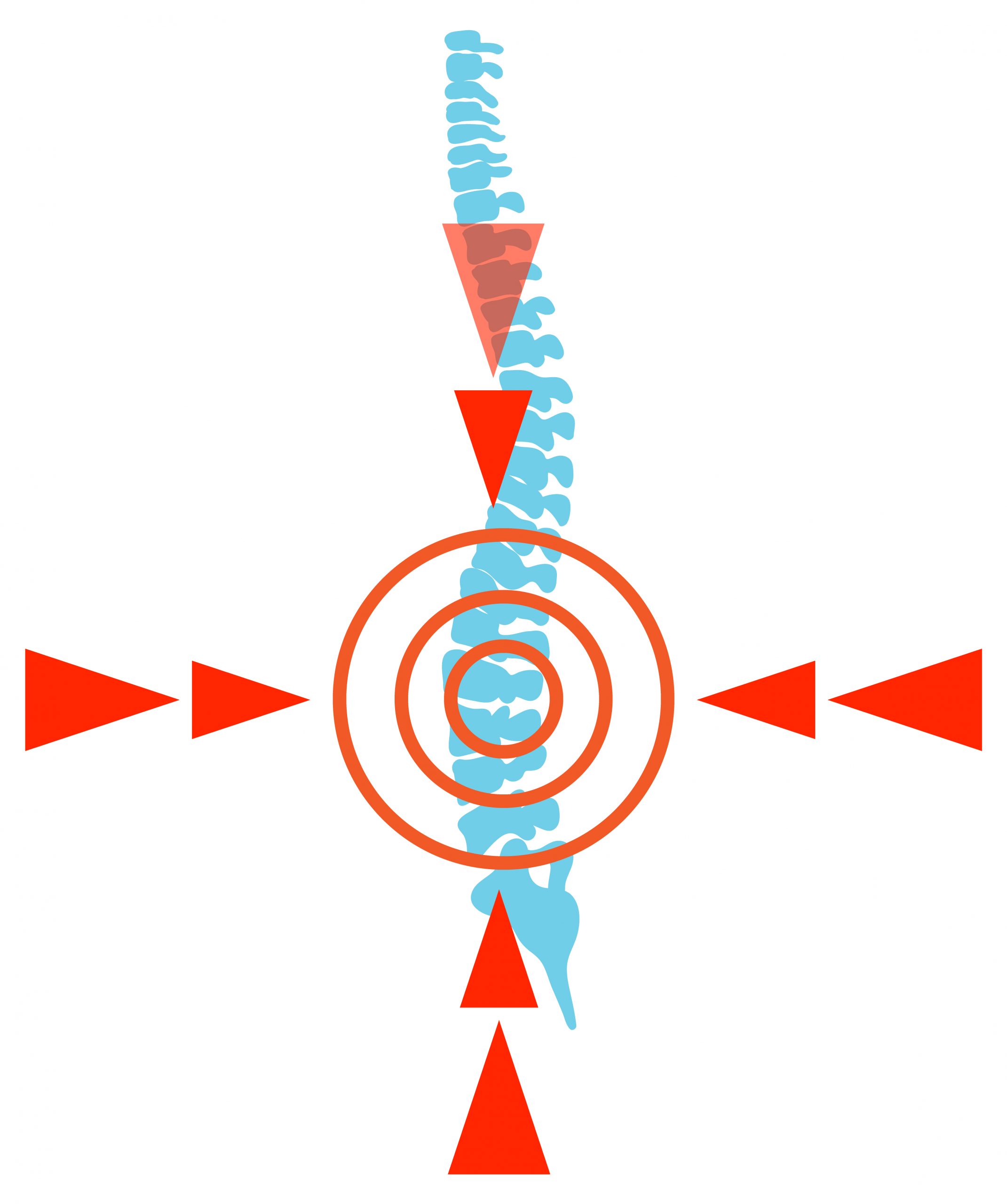 Spinal Cord Injury Causes Immunological Deficiencies