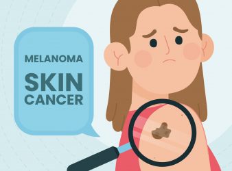 Who are more prone to skin cancer