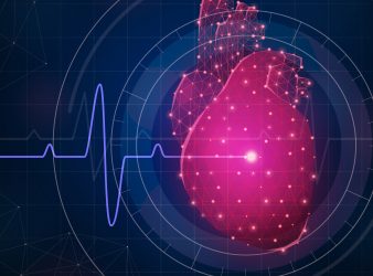 Detecting Severe Aortic Stenosis with AI