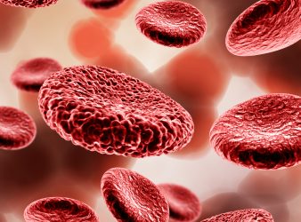 Global Anemia Cases are High Among Women and Children