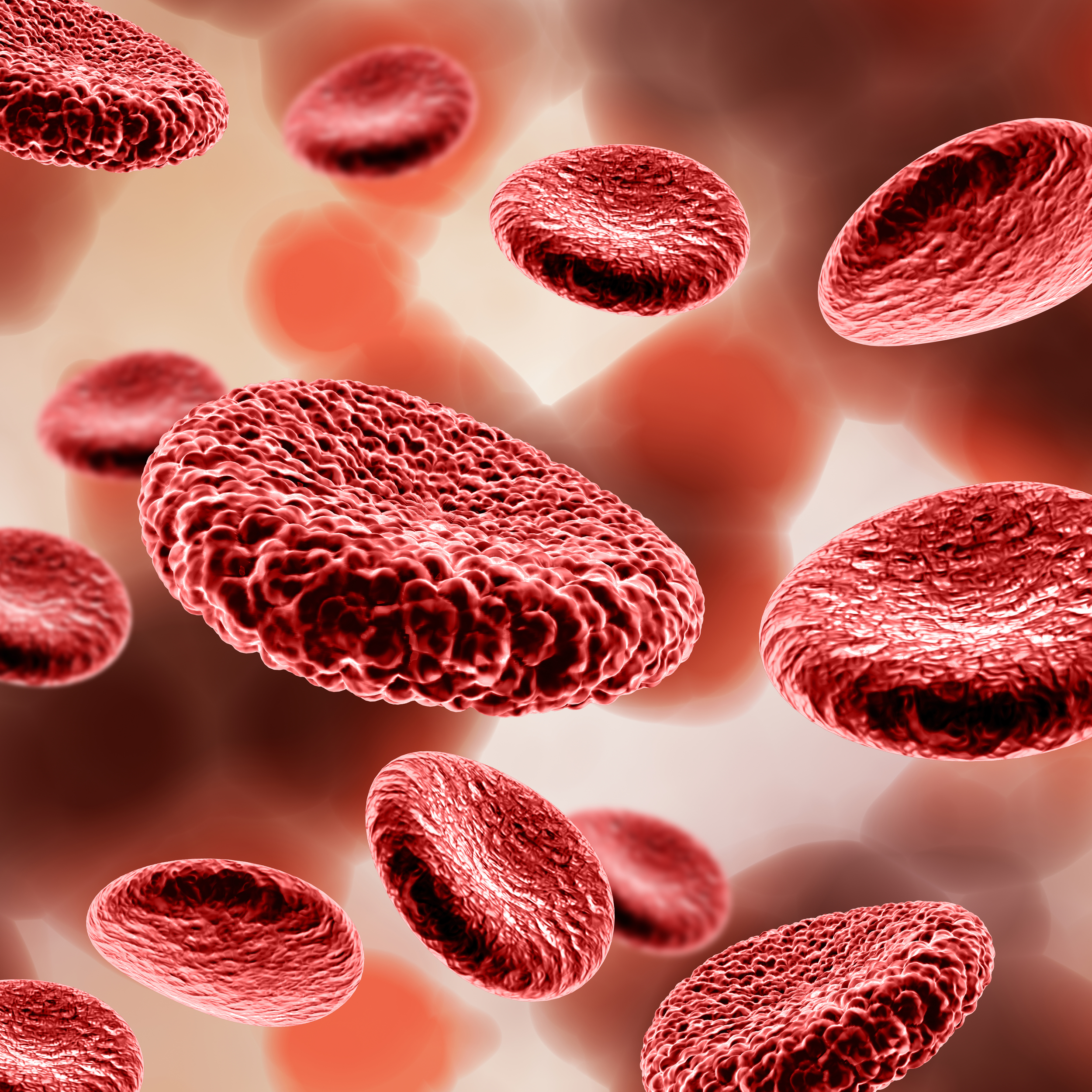 Global Anemia Cases are High Among Women and Children