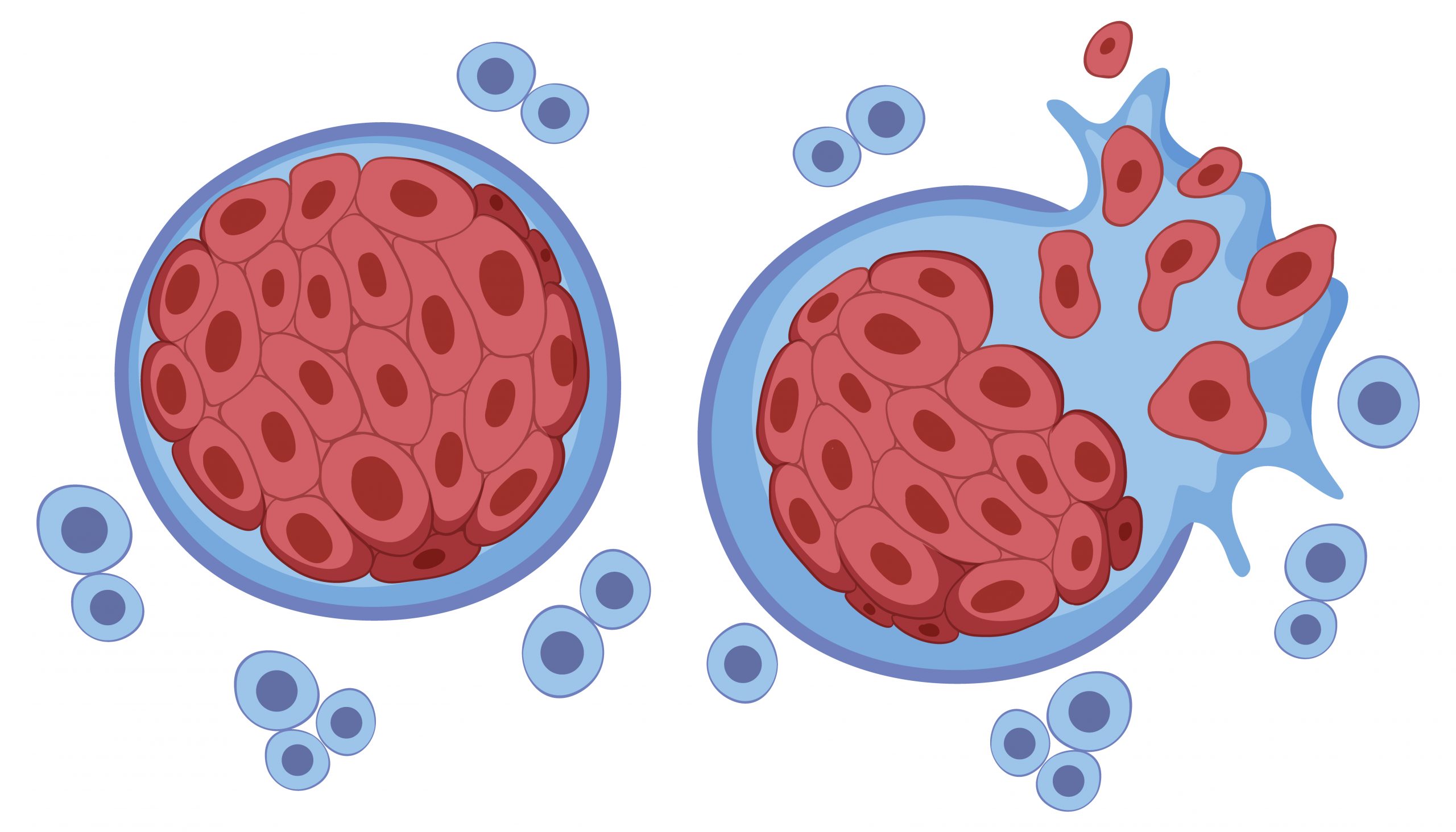 Study Shows T Cell Depletion Within Hours of Tumor Contact