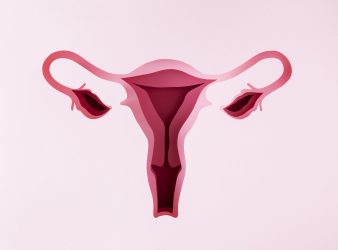 Endometriosis