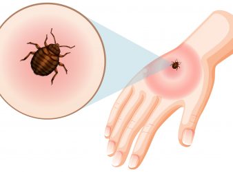 Lyme disease Patient Bacterium Samples and Symptom Disparities