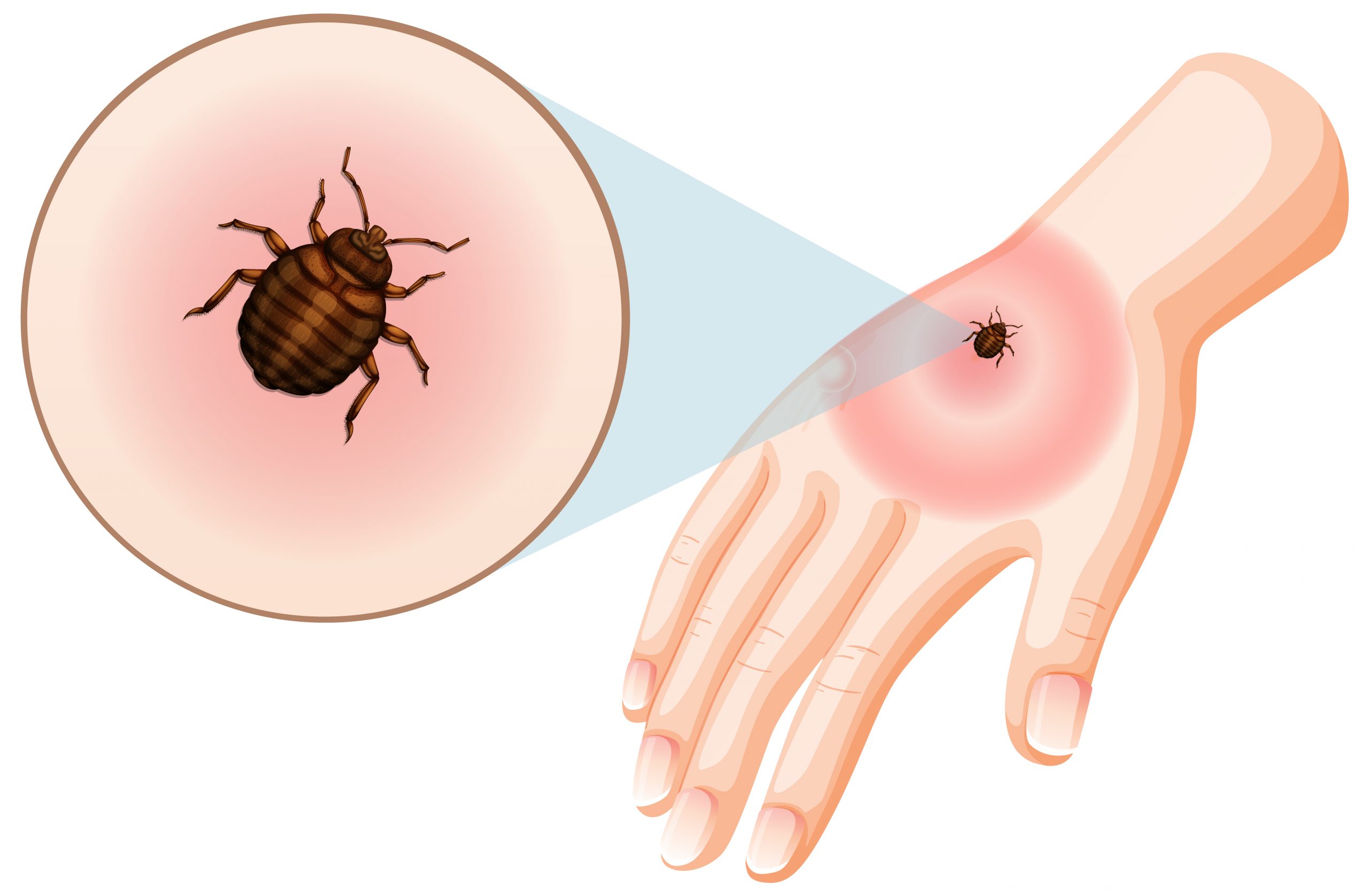 Lyme disease Patient Bacterium Samples and Symptom Disparities