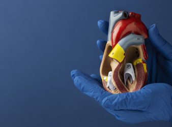 Second Transplant of Pig Heart