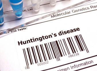 Huntington's Disease Starts Before Symptoms