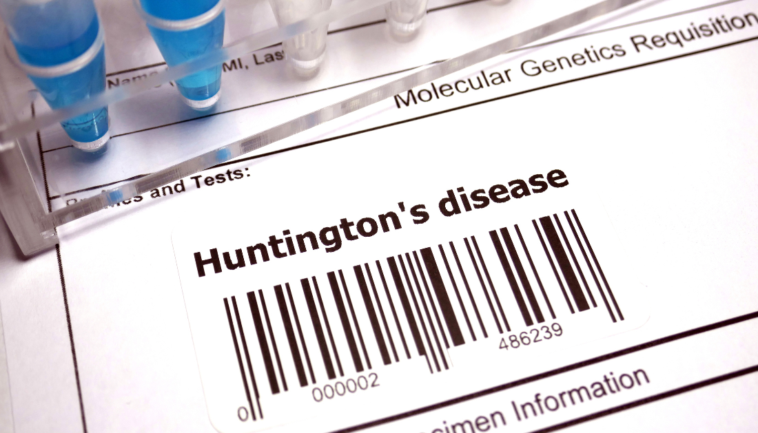 Huntington's Disease Starts Before Symptoms