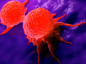 Breast Cancer Cells Work Together to Invade Surrounding Tissue