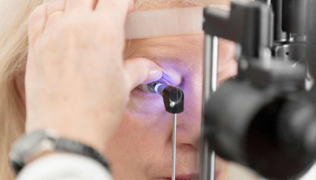 A Novel Approach to Treat Glaucoma