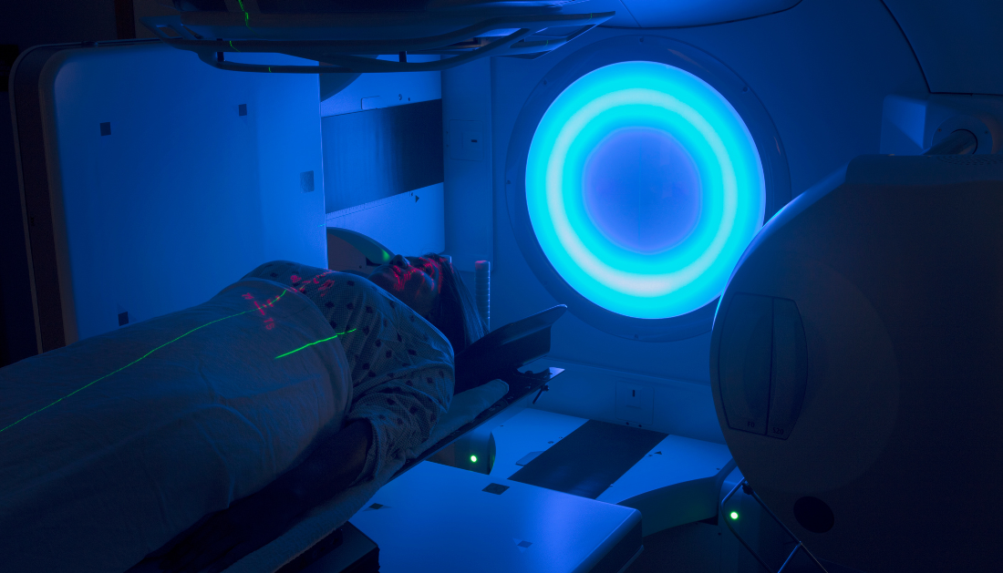 Head and Neck Cancer Radiotherapy's 'New Gold Standard' is supported by trial results
