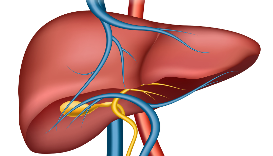 Ischemic cholecystitis