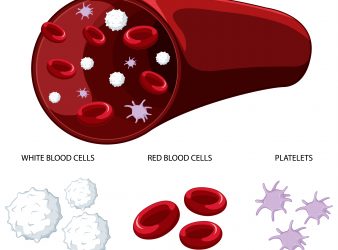 FDA Approves First Sickle Cell Disease CRISPR Gene Editing Treatment