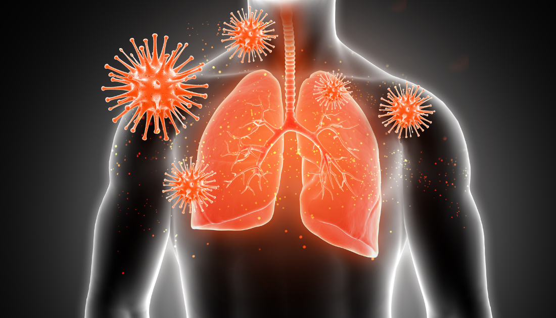 Role of Immune System in Lung Cancer