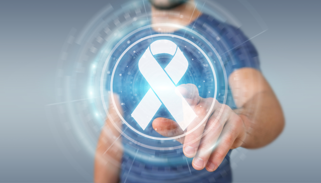 Artificial Intelligence-Prostate Cancer