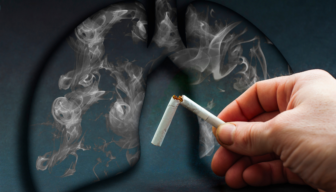 Latest insights into genetic variations impacting smoking addiction