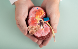 Kidney affected with CDK due to Ultr-processed Food(UPF)