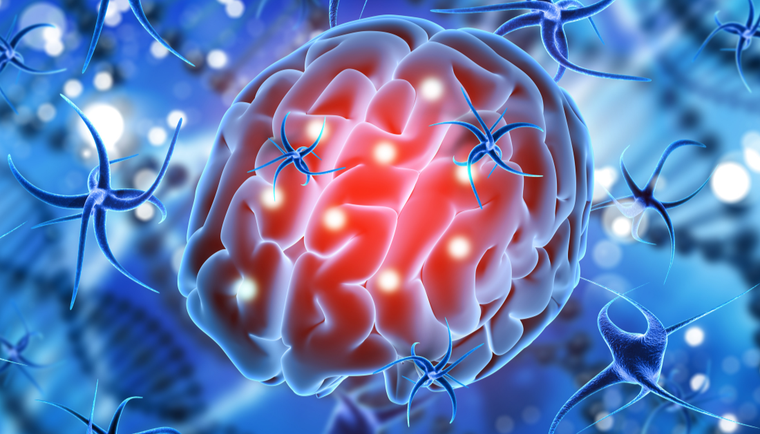 Neurodegeneration after Traumatic Brain Injury - Gladstone Institutes Research