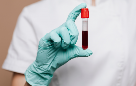 Microplastics in Human Blood: Cardiovascular Risk