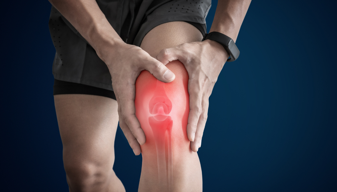 No genetic causal link found between alpha-tocopherol levels and osteoarthritis cause in recent study.