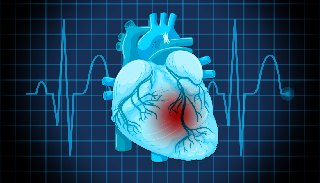 Novel Cardiac Micro-Vessels Imaging Approach for Undiagnosed Chest Pain