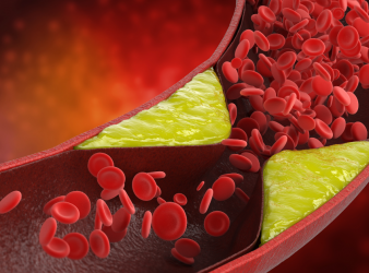 Image of a blood with a focus on cholesterol levels.