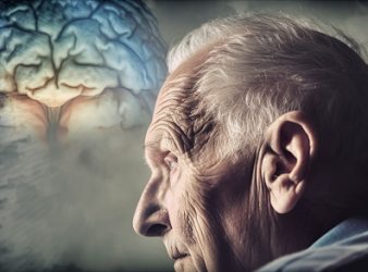 alzheimers diagnosis