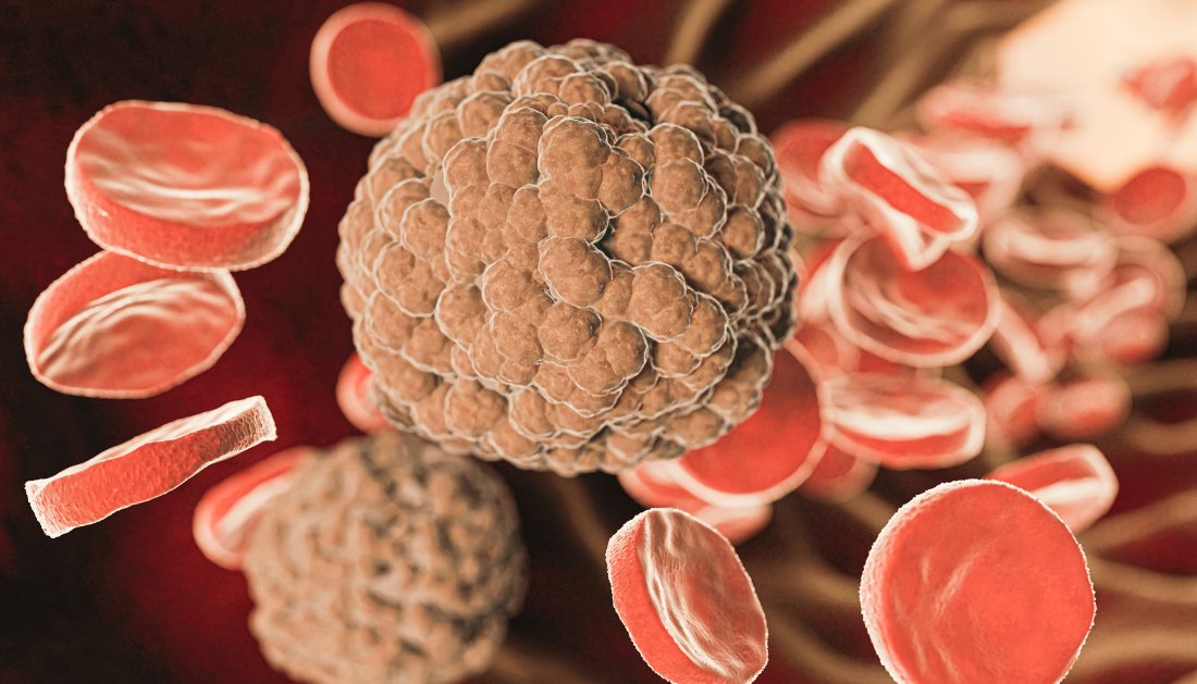 Microscopic view of cytotoxic T-cells interacting with tumor cells in the tumor microenvironment.