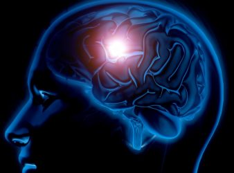 Low Teen Cognition Tied to Early Stroke Risk