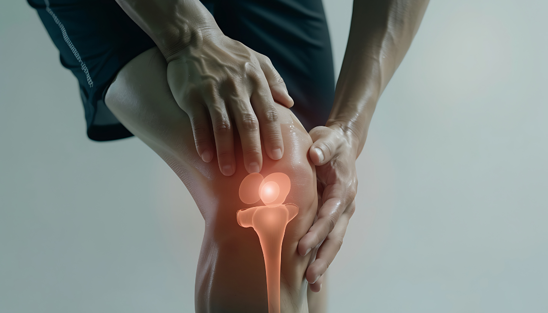 Antidiabetic Drugs May Modify Osteoarthritis Risk