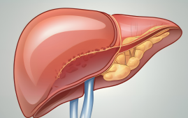 New Strategy to Prevent Fatty Liver: Study Insights