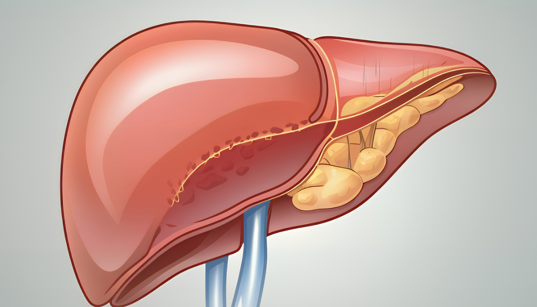 New Strategy to Prevent Fatty Liver: Study Insights