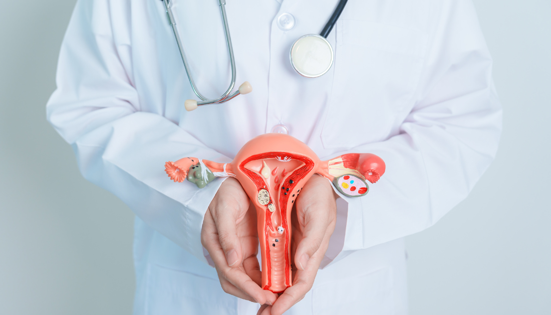 Mechanism of Immune Suppression in Ovarian Cancer Uncovered